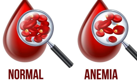 سرطان و کم‌خونی, کم‌خونی در بیماران سرطانی