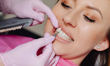 ماندگاری و دوام لمینت دندان, مراقبت از لمینت دندان