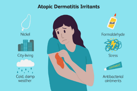 عوامل تشدید درماتیت آتوپیک, محرک‌های اگزما