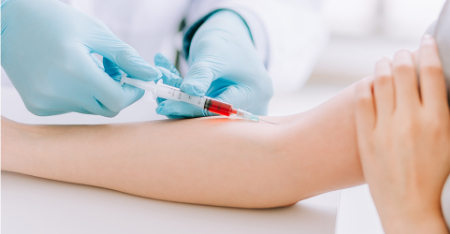 آزمایش CPK, نحوه انجام آزمایش CPK