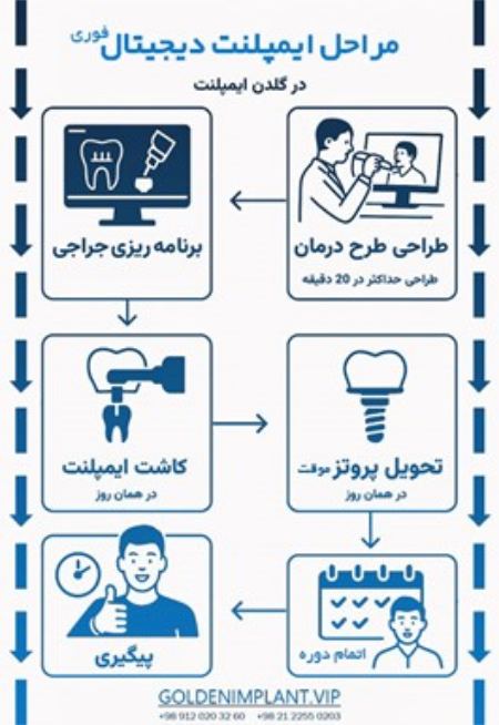 مراحل انجام ایمپلنت در مراکز تخصصی شمال تهران