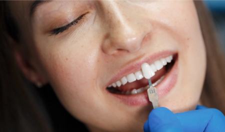 عوارض و مضرات کامپوزیت دندان