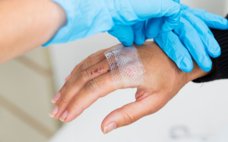 جدا کردن گاز استریل از زخم, استفاده از سرم برای جدا کردن گاز استریل