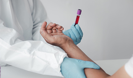 آزمایش CA19-9 چیست