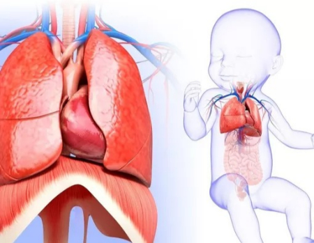 ناهنجاری مادرزادی ریه, ناهنجاری مادرزادی ریه در بزرگسالان