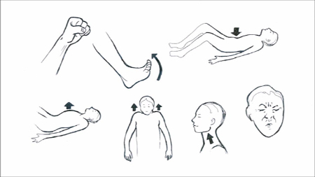 آرام‌سازی پیش‌رونده عضلانی, ریلکسیشن جاکوبسون
