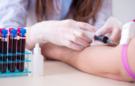  آزمایش آمونیاک سرم, آزمایش آمونیاک برای کبد