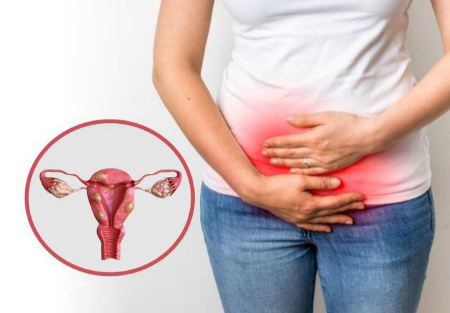 ترکیدن فیبروم رحم, عوارض فیبروم رحمی