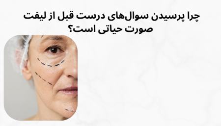 اهمیت پرسیدن سوالات مربوط به جراحی لیفت صورت