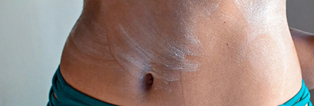 خارش شکم, خارش پوست بدن و شکم