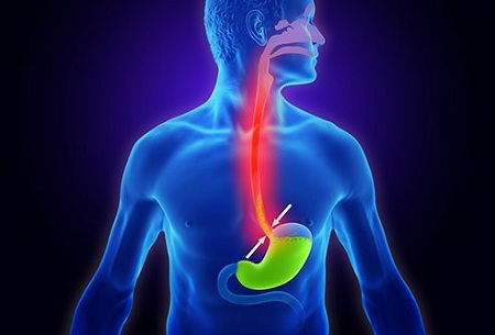 راه های تشخیص رفلاکس معده, تشخیص رفلاکس معده در کودکان با سونوگرافی, رفلاکس معده